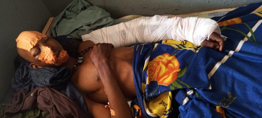 LOLA : un bouvier violemment agressé et blessé par balles à Gueassou